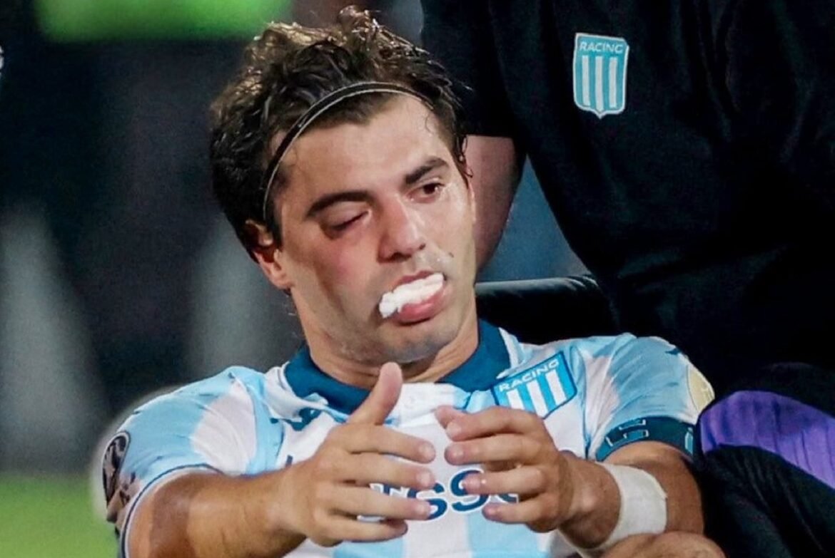 Capitão do Racing pode ficar de fora da final contra o Flamengo devido a lesão facial.